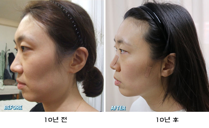 j 김혜 02