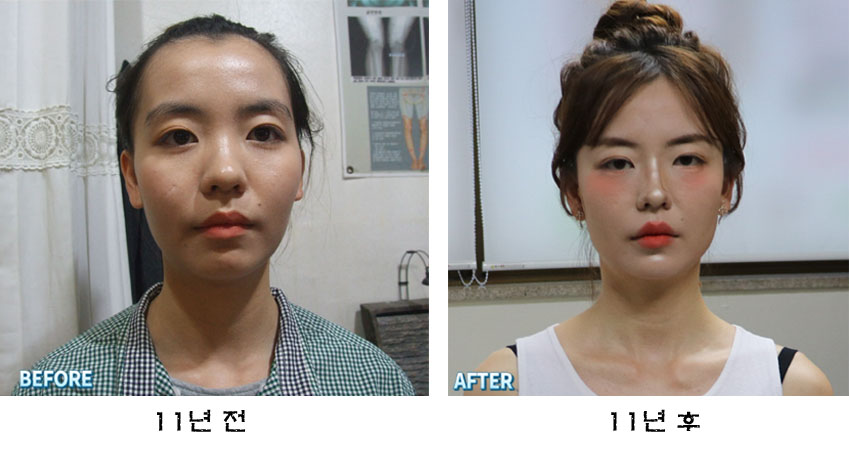 j 최소02