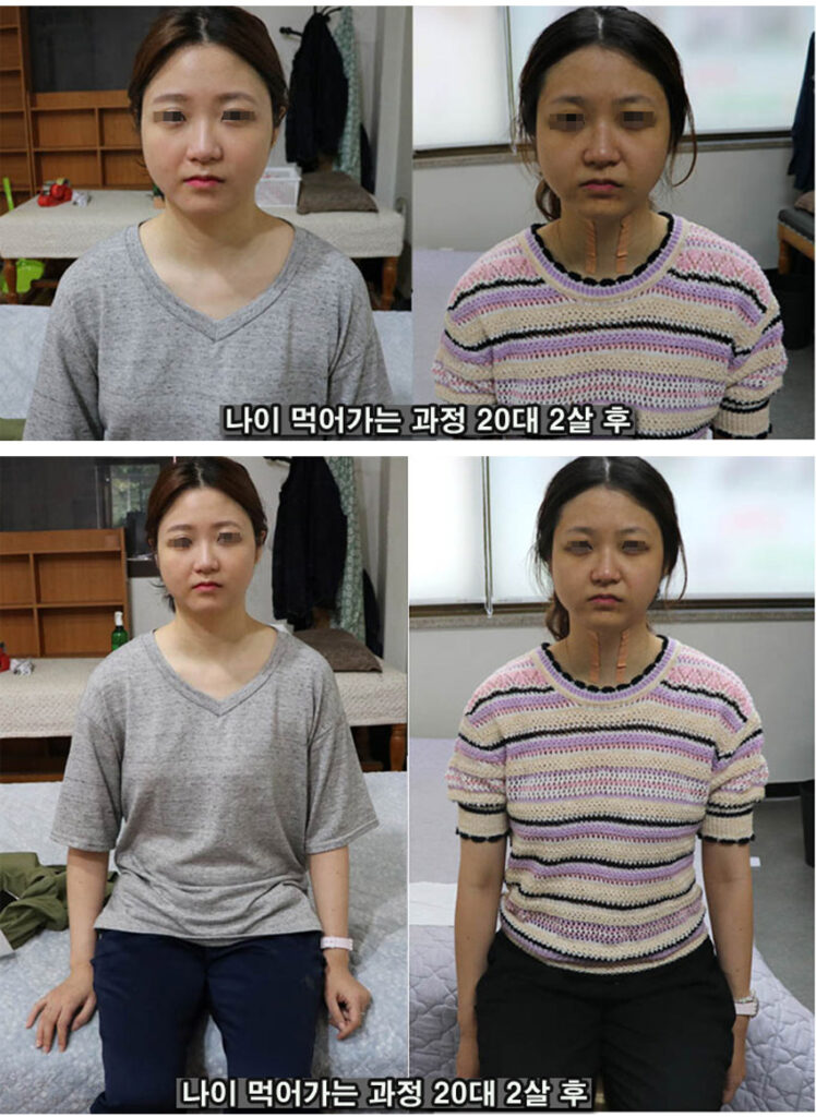 나이 1-1