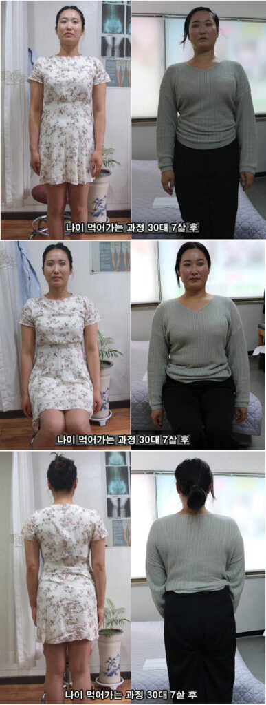 나이 1-4