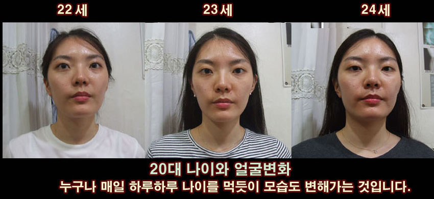 동안 1-1