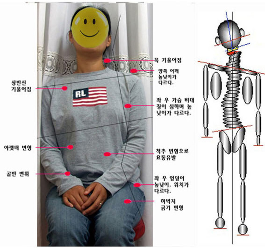 목 1