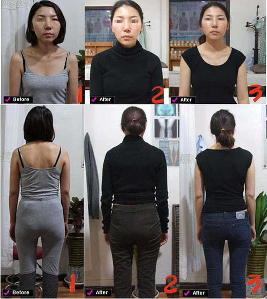 신체1