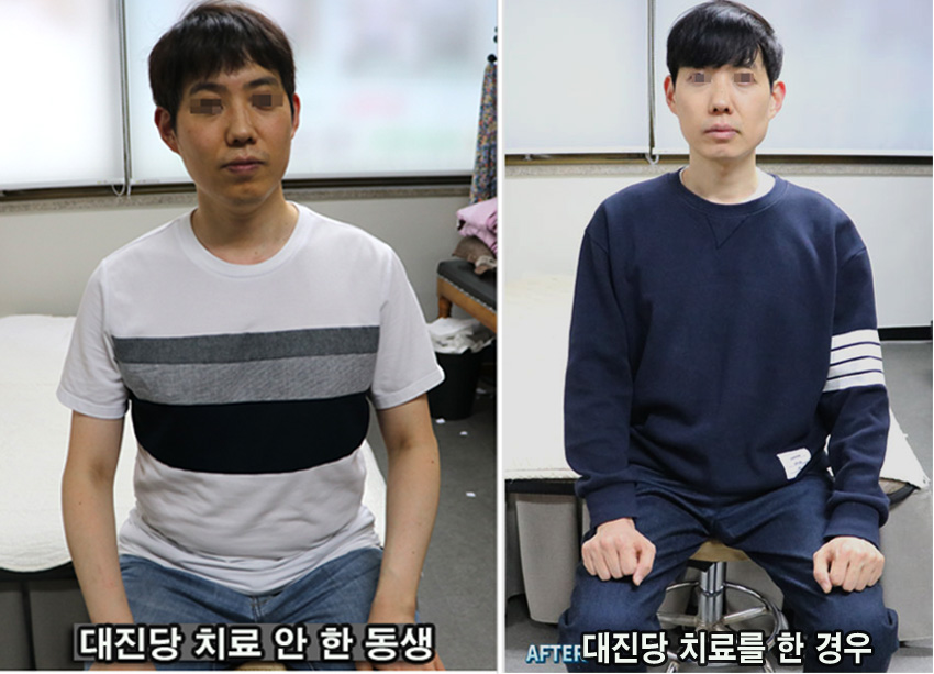 쌍둥이 비교 02 복사