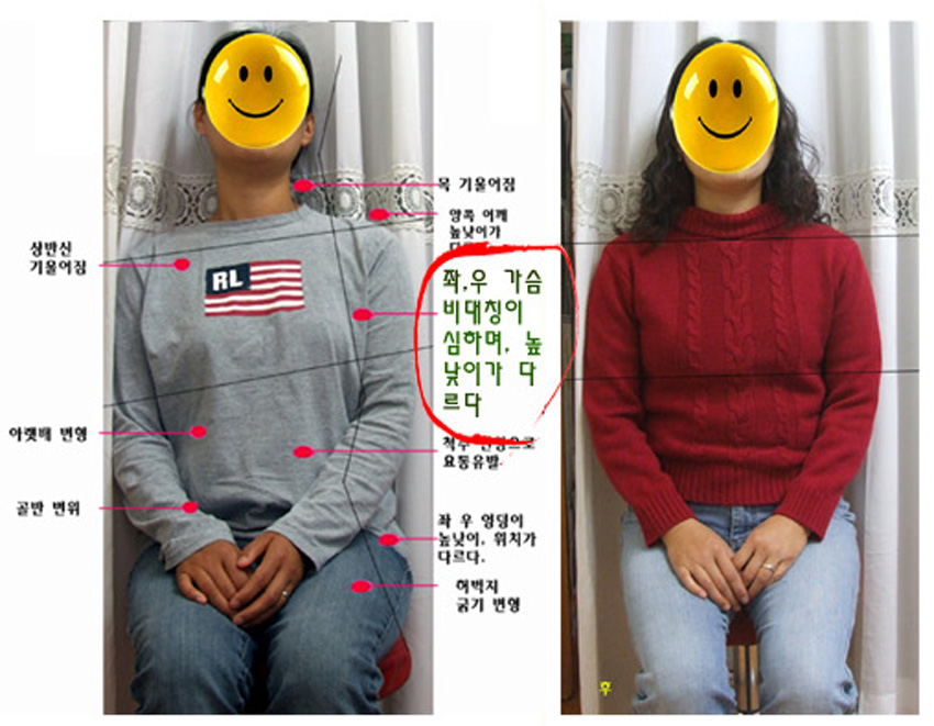 가슴 1