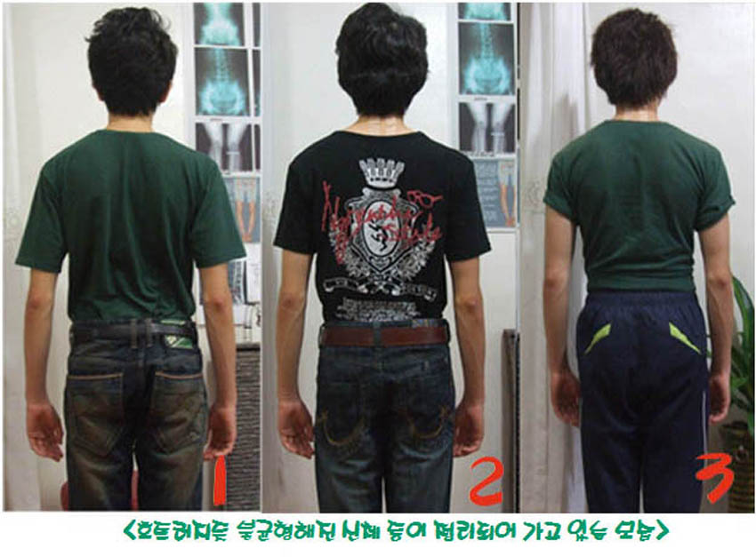 골반 6-03