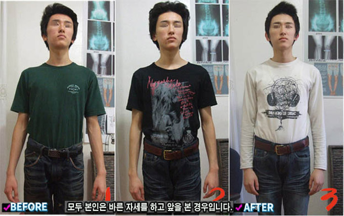 골반 6-04