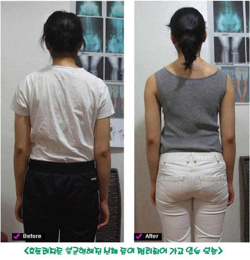 골반 6