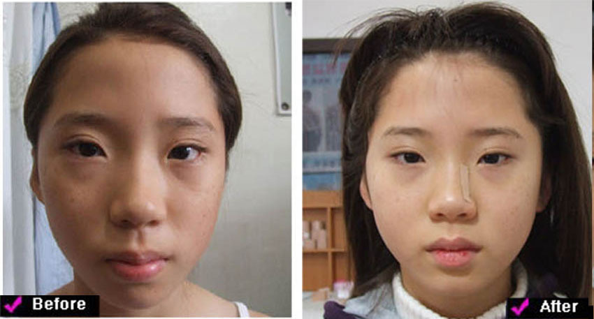 lg_c16697045396731_%EB%88%88%EC%9D%B4%EB%A7%88_3_-_%EB%B3%B5%EC%82%AC%EB%B3%B8.jpg