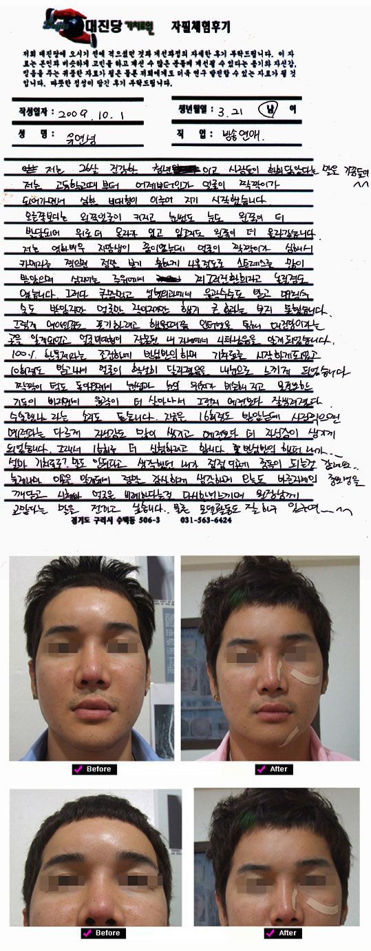 성형외과 윤곽수술도 받고 대칭수술도 받았지만......