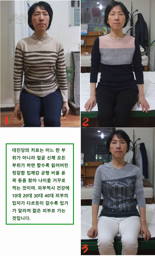 안면비대칭 휘어짐 틀어짐 나이 등이 관찰이 되는가？