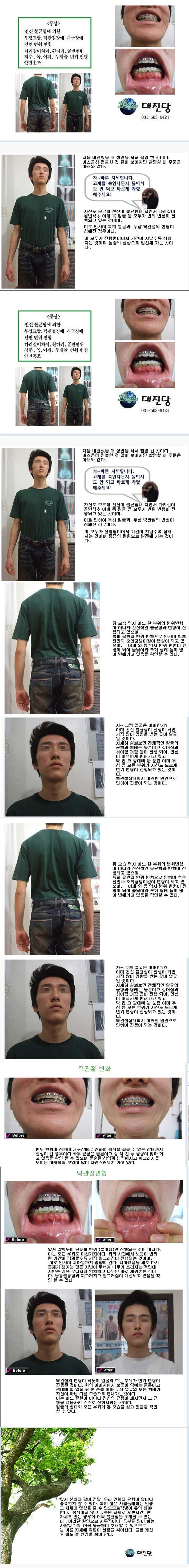 신 체 안면 턱 변형등 개선 과정 