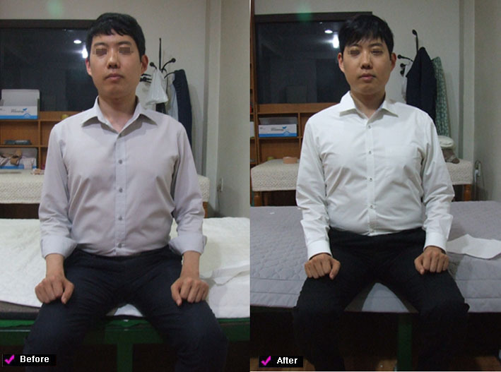 얼굴 신체 등 본인 스스로  관찰하는 안목이 있어야 한다.       전 후  