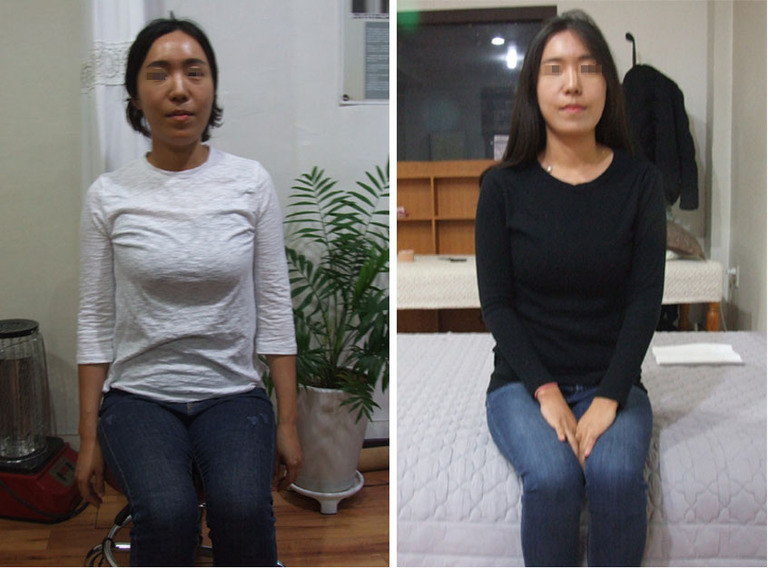 나이 먹어가는 과정과 - 대진당 치료의  개선되어지는 과정   