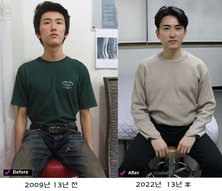 대진당 13년 전 후 