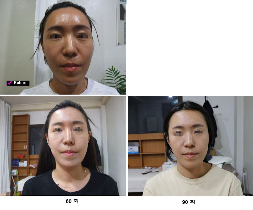 lg_i15573900836308_90-1-%EB%AA%A8.jpg