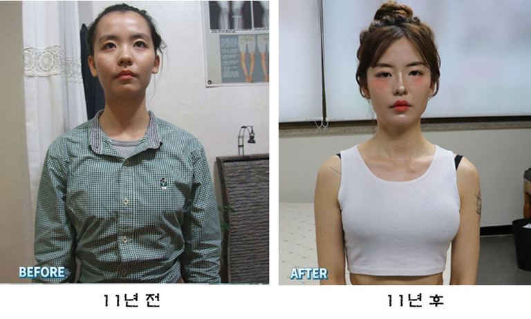 대진당 관리 11년 전 후 