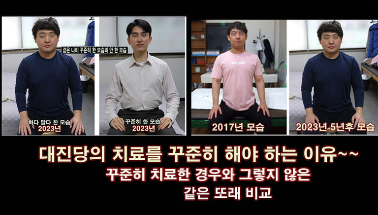 ﻿대진당의 치료를 꾸준히 해야하는 이유~    꾸준히  한 경우와  비교  대진당 기클리닉   