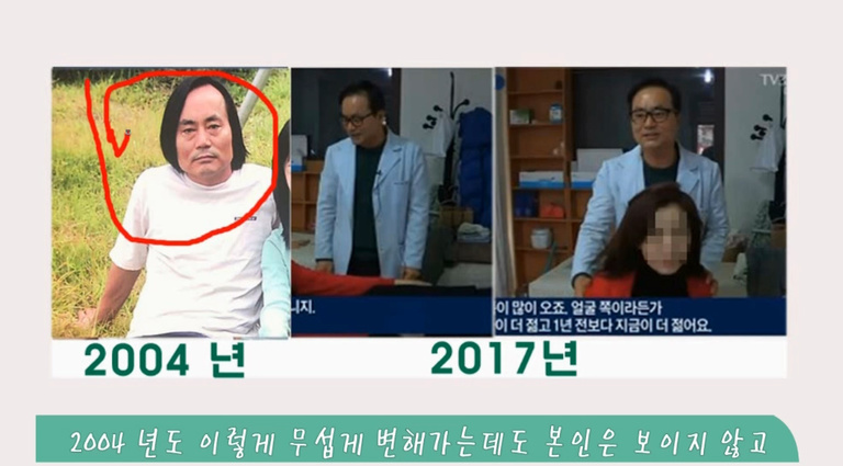15~ 20년 전보다 더 젊고 나이를 거꾸로 먹어가는 모습의 영상