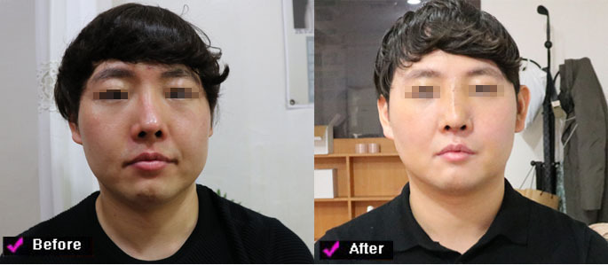 ﻿26~30 나이들어 가는 과정과 대진당 치료 개선되어지는 과정 ...