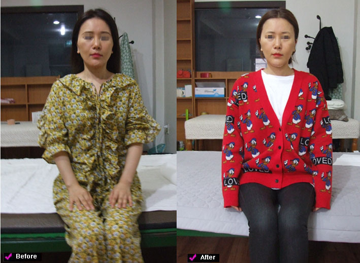 굴도 얼굴이지만 신체역시 나이가 들수록 얼굴보다 더욱 변형이 심화되는 것이다, 대진당 기치료원 