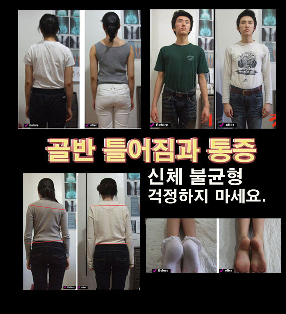 골반 틀어짐과 통증 신체 균형 다리길이 휜다리 