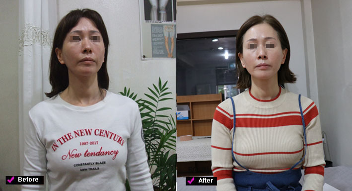 lg_v15584933460562_%EC%95%84%EB%82%9C%EC%98%81%EB%8B%98_2_%EB%AA%A8.jpg