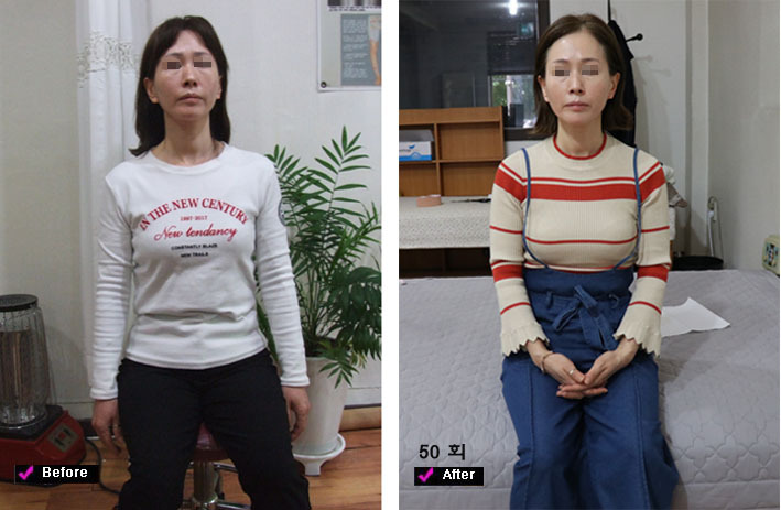 50 회 전 후  대진당 기치료원 