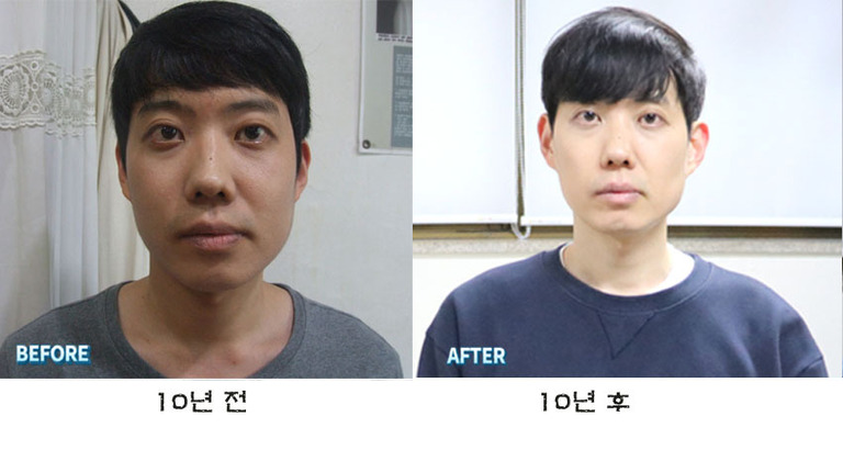 10년 전  후 