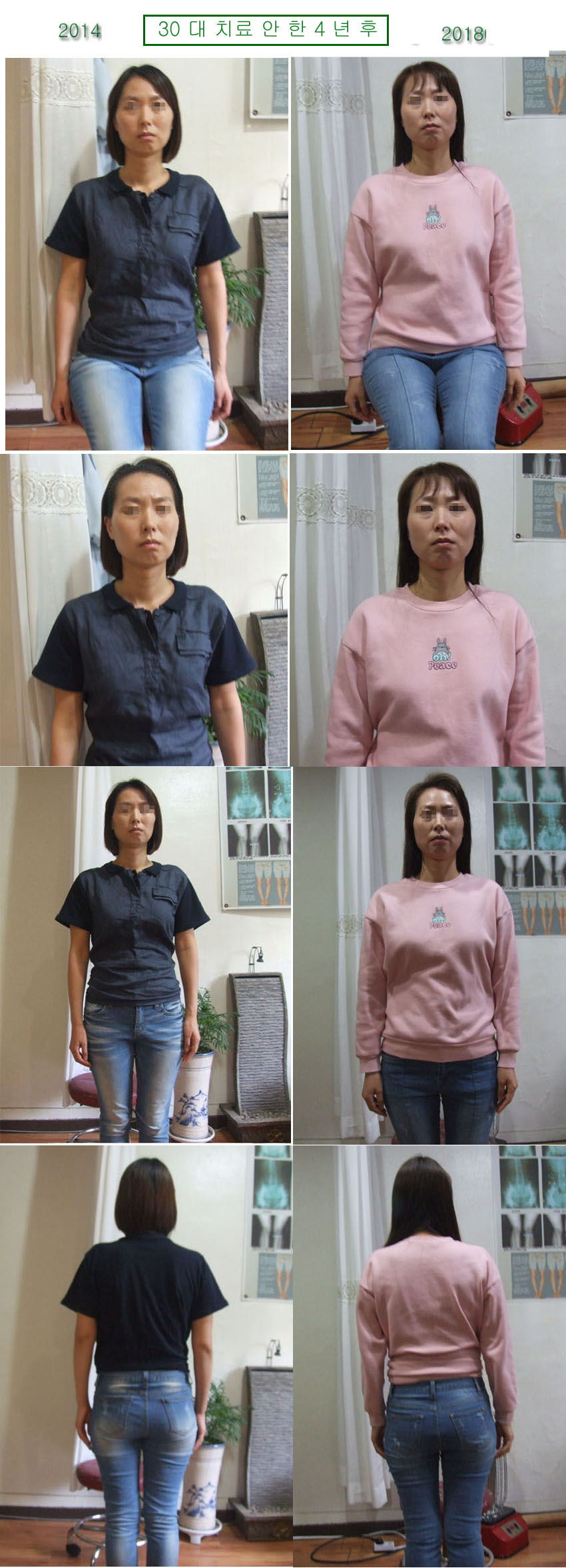 lg_w15297371750208_%EB%AC%B8%EB%AF%BC%EC%A0%95%EB%8B%98.png