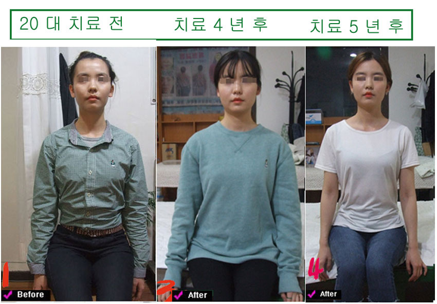lg_w15297372357154_%EC%B5%9C%EC%86%8C%EB%8B%B4%EB%8B%98_%EB%B3%B5%EC%82%AC.jpg