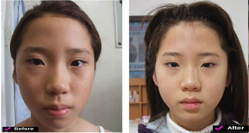 lg_z15852131210167_%EB%88%88%EC%9D%B4%EB%A7%88_3.jpg