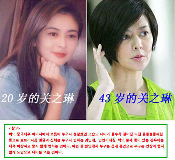 환불제 골반교정 척주교정 문의
