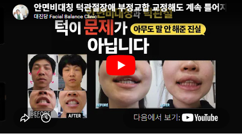 안면비대칭·턱관절장애, 교정해도 자꾸 틀어지는 진짜 이유 (원인은 턱이 아닙니다) 대진당