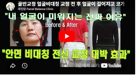 [골반교정/얼굴비대칭] 거울 볼 때마다 스트레스? 진짜 원인은 '얼굴'이 아닙니다